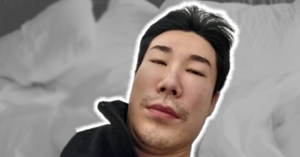 "오랜만입니다" 래퍼 산이, 퉁퉁 부은 얼굴 '진짜 아파' 충격 근황