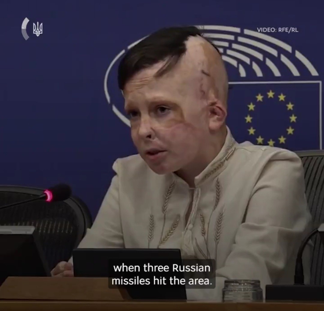 우크라 아이들 계속 도와주세요